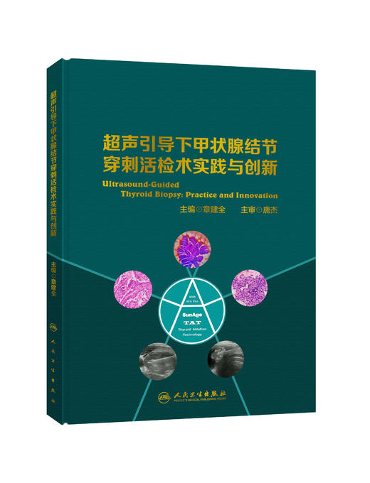 超声引导下甲状腺结节穿刺活检术实践与创新 商品图0