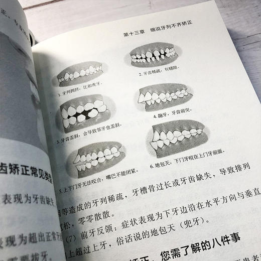 齿健身安 徐定南 口腔疾病护理书籍 口腔健康常识 牙痛口腔溃疡牙病防治书正确刷牙方法牙膏牙刷牙线牙签选购指南洗牙拔牙注意事项 商品图3