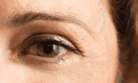  不管你的眼袋、黑眼圈有多深，用它一抹，70岁前都有救！ 