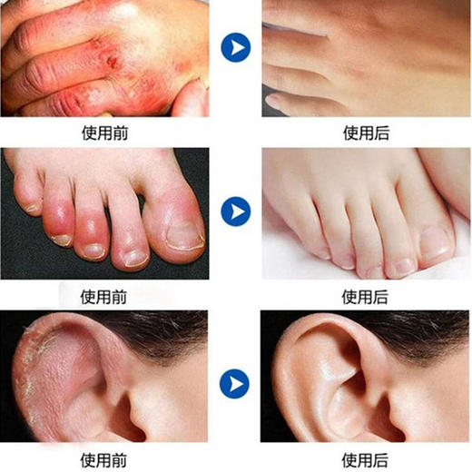 【买2发5，人保担保】鳄鱼油防冻膏告别皲裂润泽肌肤修护手脚干裂水嫩滋补不油腻 商品图3