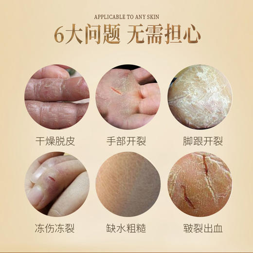 马油膏防干裂脚后跟皲裂龟裂修复霜护手霜女男秋冬开裂脱皮护足霜 商品图2