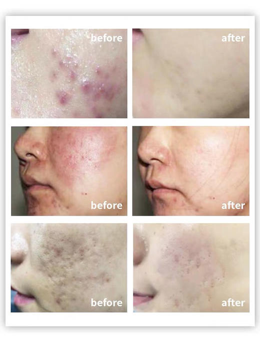 皮肤重建！会飞的冻干粉！柏翠丝壹创育颜冻干粉！小小一瓶就有8大砖利！ 商品图1