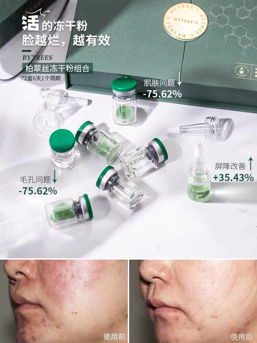 皮肤重建！会飞的冻干粉！柏翠丝壹创育颜冻干粉！小小一瓶就有8大砖利！ 商品图0