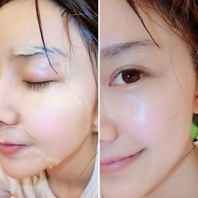 为什么一到换季皮肤就过敏？如何避免？