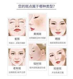 长斑是身体给你最后的警告！