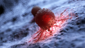  李可丨为什么经过手术肿瘤还可能扩散？顾护胃气为第一要领！ 