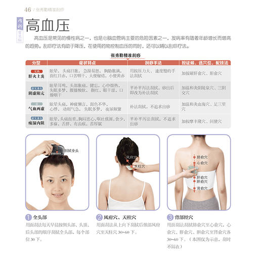 张秀勤精准刮痧 商品图6