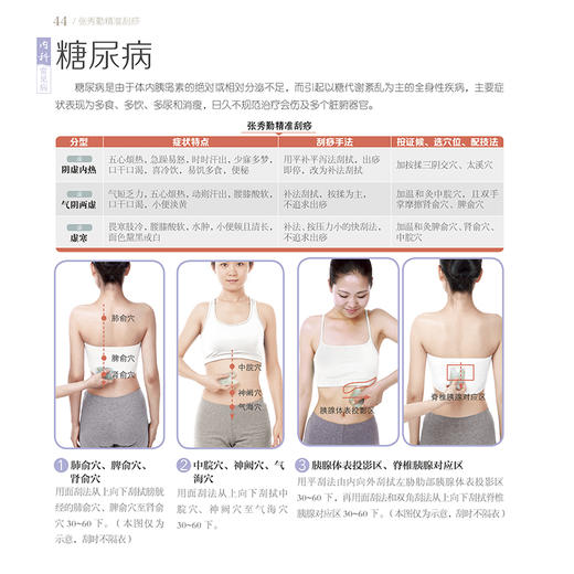 张秀勤精准刮痧 商品图4