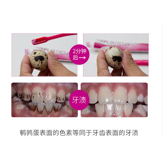 【马泷专属】瑞士原装进口怀尔德Dr.wild 抛光去渍牙膏+钻石粉牙膏 套装 商品图13