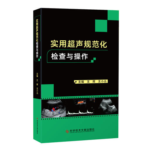 【1】实用超声规范化检查与操作 商品图0