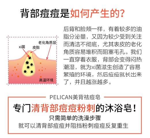 日本原装Pelican for back背部后背护理香皂背上痘粉刺美背皂135g 商品图2