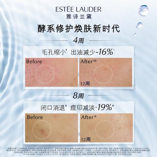 雅诗兰黛第二代高肌能原生液200ml/400ml 微精华水干皮补水保湿修护舒缓提亮收缩 商品图2