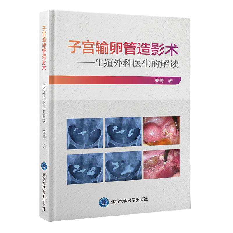 子宫输卵管造影术——生殖外科医生的解读  关菁 著  北医社