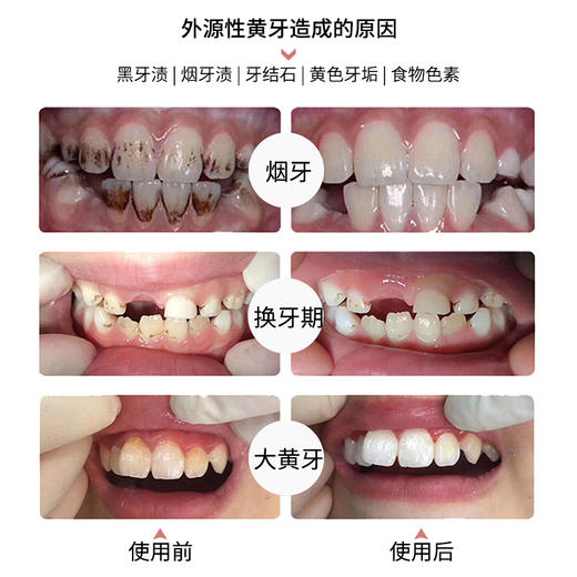 【马泷专属】瑞士原装进口怀尔德Dr.wild 抛光去渍牙膏+钻石粉牙膏 套装 商品图5