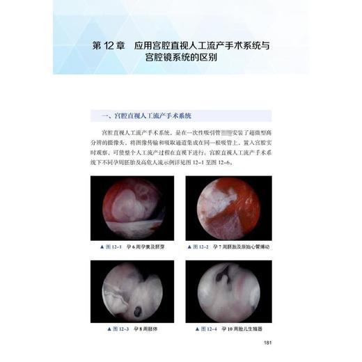 宫腔直视人工流产手术高级培训教程 商品图4