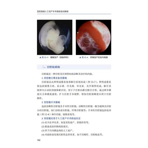 宫腔直视人工流产手术高级培训教程 商品图2