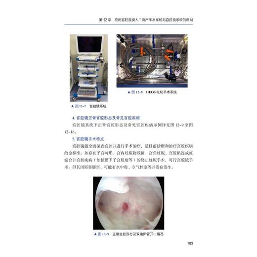 宫腔直视人工流产手术高级培训教程 商品图1