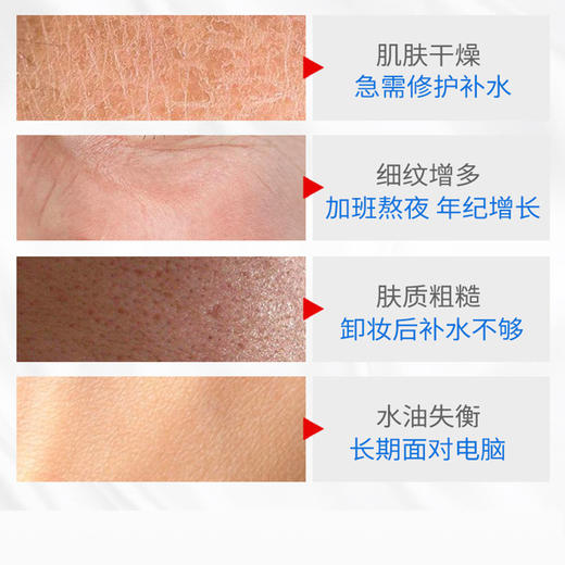 「拍1发4！4瓶装」维生素E乳协和维ve乳液100ml 商品图2