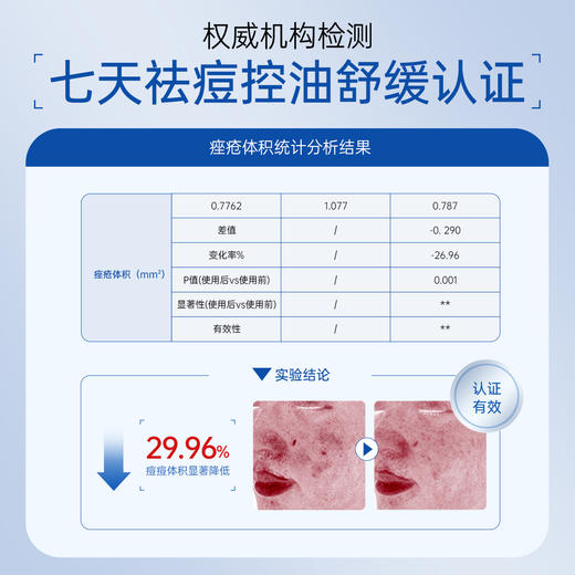 【品牌直发】斐思妮祛痘控油水杨酸面膜 商品图2