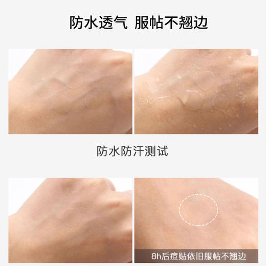 进口水胶痘痘贴防水便携隐形痘印贴不卡粉24粒/板 商品图1