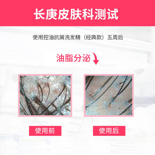 台塑生医多福美乐经典款控油抗屑洗发水580g油性发质适用 商品图2