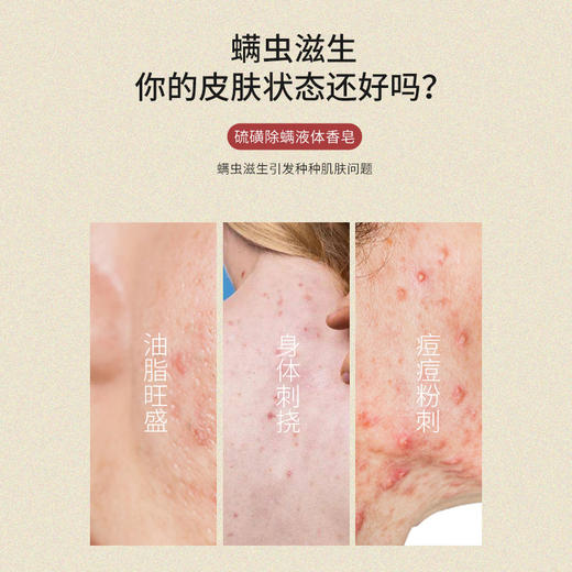 【广药白云山除螨沐浴露】液体香皂 深层清洁祛痘去螨虫 硫磺沐浴露 商品图1