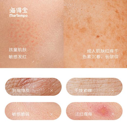 ²【海得宝清爽5x面霜】脸蛋水润不干燥 守护娇嫩肌肤 HM02-CRMM-HDB 商品图1