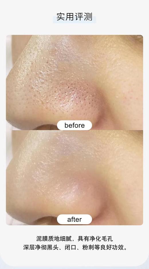 科颜氏（Kiehl's）白泥清洁面膜125ml 商品图6