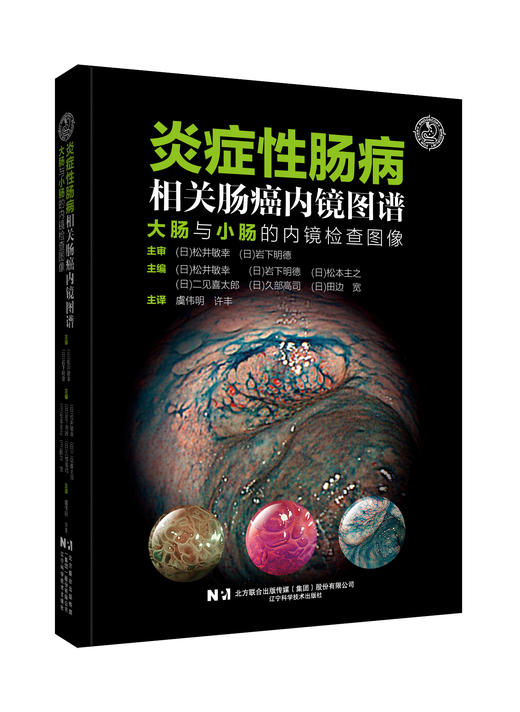 新书现货 炎症性肠病相关肠癌内镜图谱：大肠与小肠的内镜检查图像 商品图0