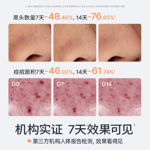 海龟爸爸 青少年抗初痘系列双萃控油祛痘洁面乳精华水乳套装 商品图4