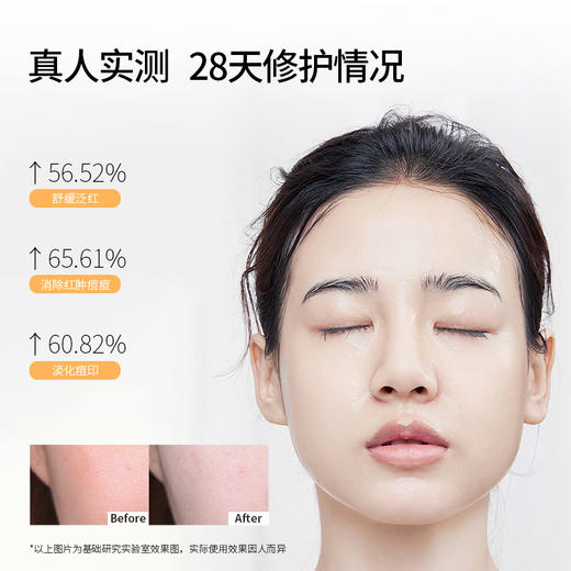 【铂鱼修护1.0 改善红敏/受损肌】铂鱼修护水 精华 乳 敷贴非面膜 械字号医用胶原蛋白医美补水舒缓泛红敏感修复 商品图1