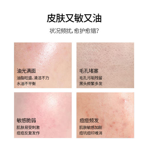 【铂鱼祛痘2.0 一套KO油痘肌】铂鱼祛痘修护洁面慕斯 水 精华 乳 次抛 敷贴 肌肤痤疮粉刺 毛孔粗大 痘印 械字号医用胶原蛋白医美补水舒缓泛红敏感修复 商品图3