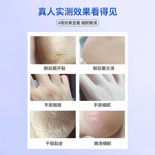 【俄罗斯进口】俄罗斯PANNAKISS普娜之吻防干裂膏50克/瓶  多重护肤成分 止痒修复 防冻防裂 商品图3