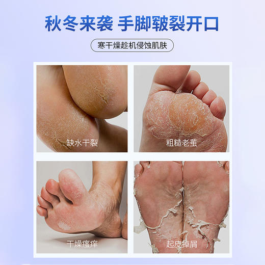 【俄罗斯进口】俄罗斯PANNAKISS普娜之吻防干裂膏50克/瓶  多重护肤成分 止痒修复 防冻防裂 商品图1