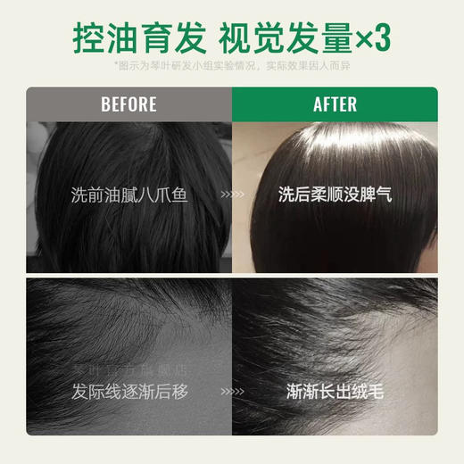 琴叶防脱发控油洗发水（控油清新松木）750ml 商品图4