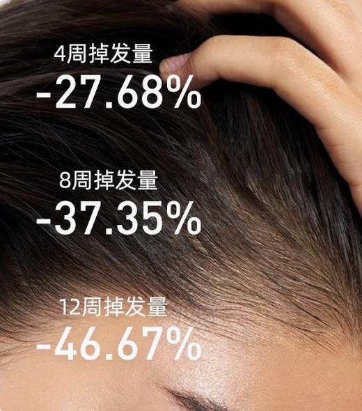 海瑟薇洗发水（防脱固发）500ml生姜 商品图2