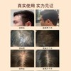 苏图仕SUTUS防脱固发洗发露 商品缩略图2