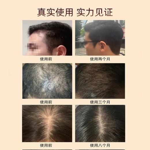 苏图仕SUTUS防脱固发洗发露 商品图2