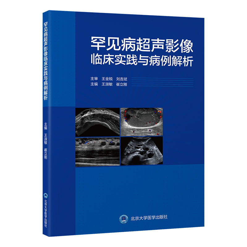 罕见病超声影像临床实践与病例解析   王淑敏　崔立刚 主编   北医社