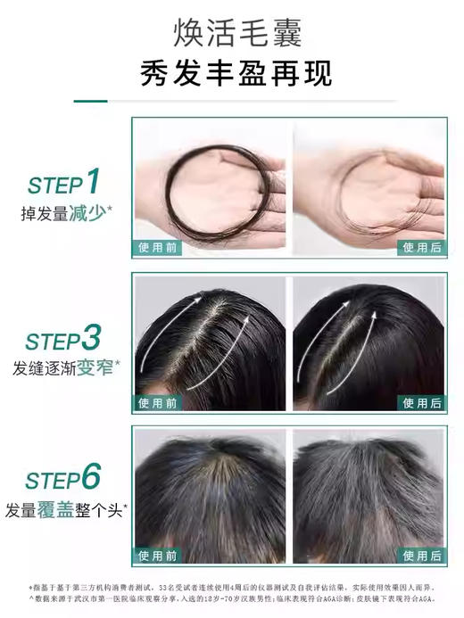 域发 | 腺苷头皮营养液 | 滋养发根 补充发根营养 呵护头发生长 改善头皮微环境 免洗 商品图5
