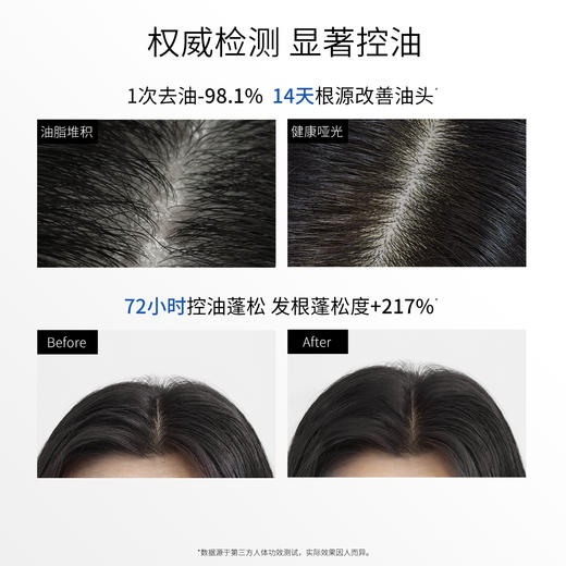 3odice三蒂丝 蓝盾洗发水油扁塌适用【中欧专属】 商品图3