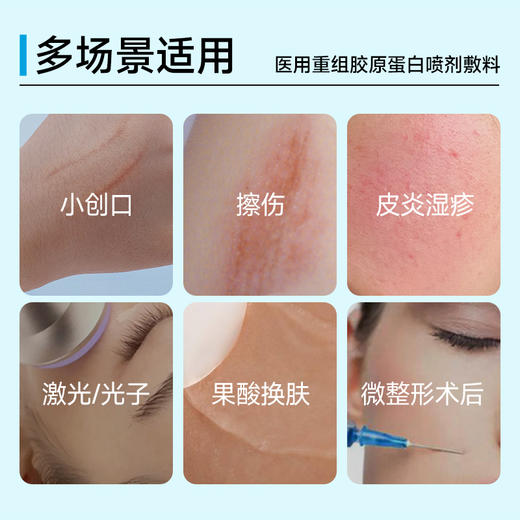 悦丝汀医用重组胶原蛋白喷剂敷料 光子水光术后创面械号修复喷雾 商品图5