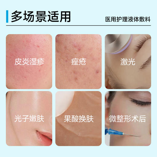 【加价购，单拍不发货】悦丝汀医用护理液体敷料次抛皮炎湿疹激光光子术后创面屏障修复 商品图5