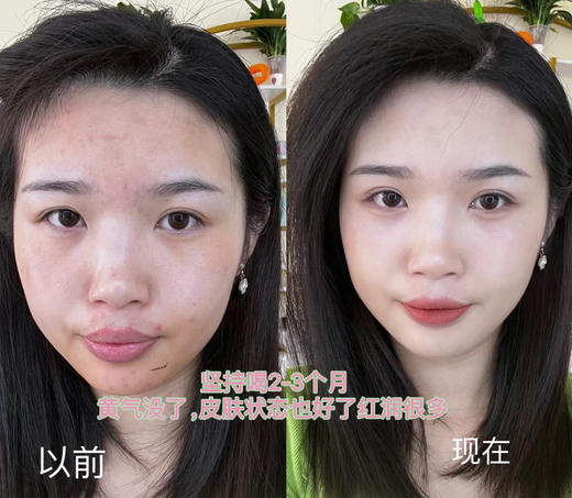 🔥伊能静同款素颜水❗️升级麦冬版本❗️高品质 【顾青山苹果黄芪素颜水】一起摆脱妈生黄皮~🥰学医的姑姑让我每天喝的去黄元气水🍎（48小时内发货 ） 商品图4