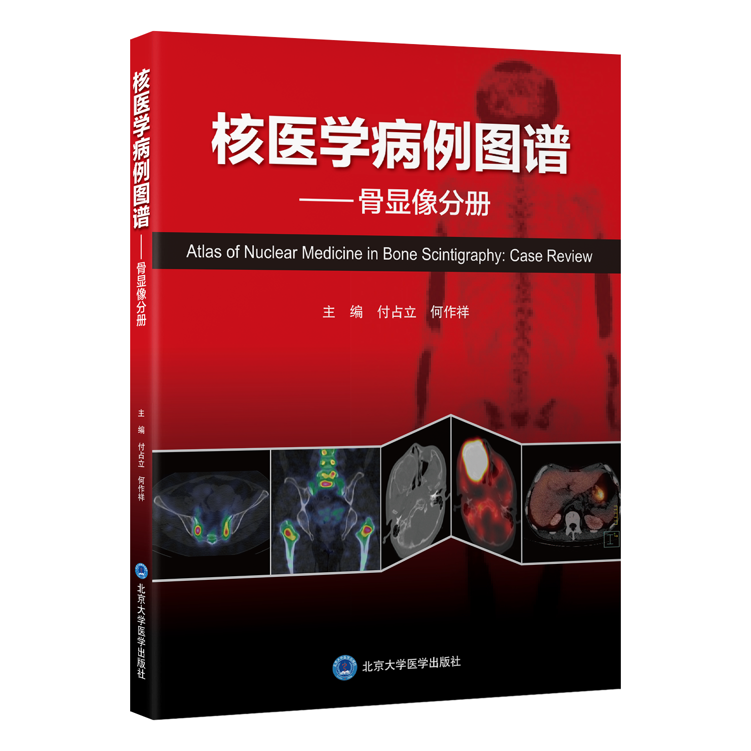 核医学病例图谱——骨显像分册   付占立　何作祥 主编   北医社
