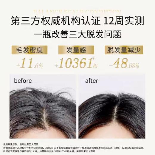 滋源生姜强根健发洗发水【宝库优选】 商品图3