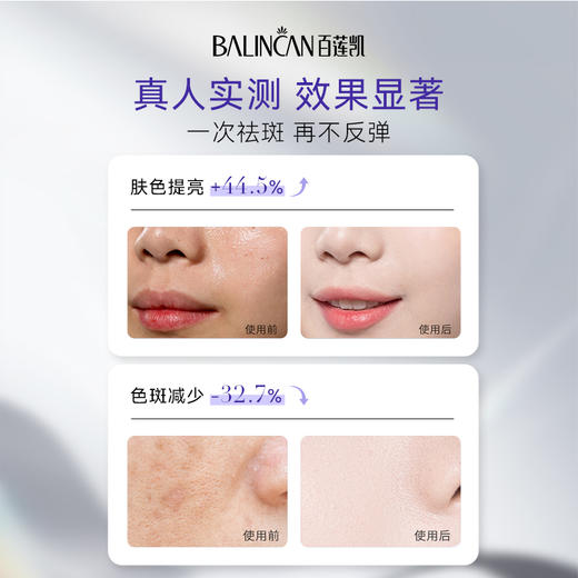 【热卖中】逆光润白祛斑霜*577超强祛斑成分 商品图3