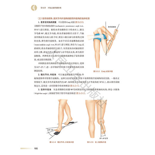 膝关节周围截骨术 王飞 主编 详细阐述了各类术式的历史 手术适应证和禁忌证 术前评估与规划 术后康复及临床效果等人民卫生出版社 商品图4