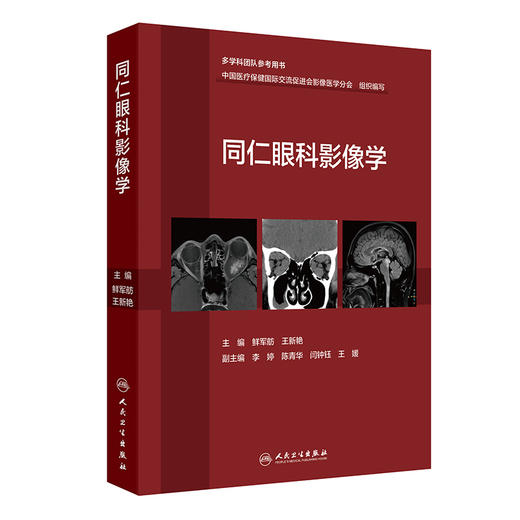 同仁眼科影像学 鲜军舫 王新艳 主编 适合于影像科医师 眼科医师 放射治疗科医师及相关人员参考 9787117379977人民卫生出版社 商品图1