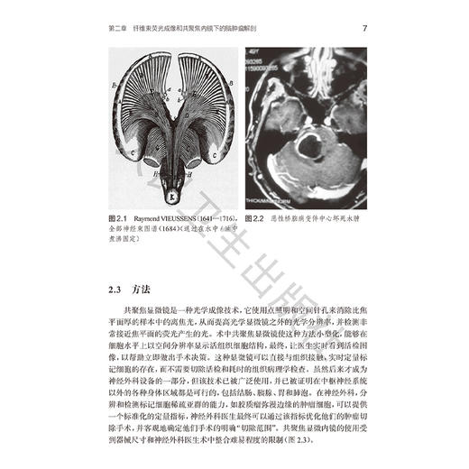 经颅内镜手术 提高术中可视化的标准 郭致飞 赵兵 主译 为神经外科医生提高术中可视化水平提供宝贵的指导 人民卫生出版社 商品图4